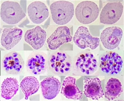  Plasmodium!  Bu Kan Paraziti Nasıl Hayatını Sürdürür?