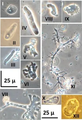  Rizomorpha: Hızlı Yayılan Bir Kök Ağı Oluşturan Gizemli Bir Amoeba Türü mü?